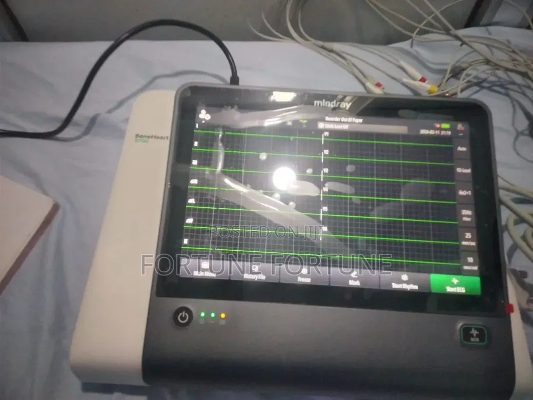 Mindray Ecg
