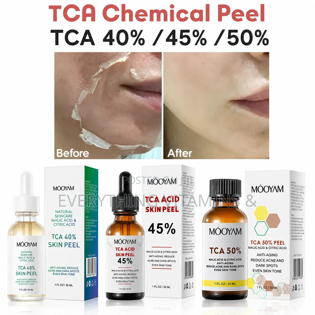 Tca Peel 40%, 45% and 50%