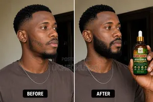 Beard Growth and Patch Repair Oil