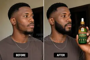 Beard Growth and Patch Repair Oil