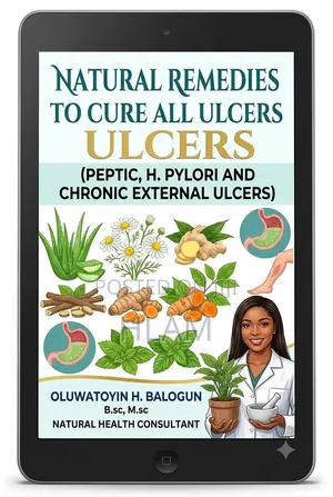 Natural Remedies to Cure All Ulcers (Peptic Chronic External Ulcers)
