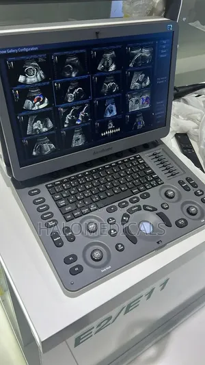 E2 Portable Ultrasound Machine