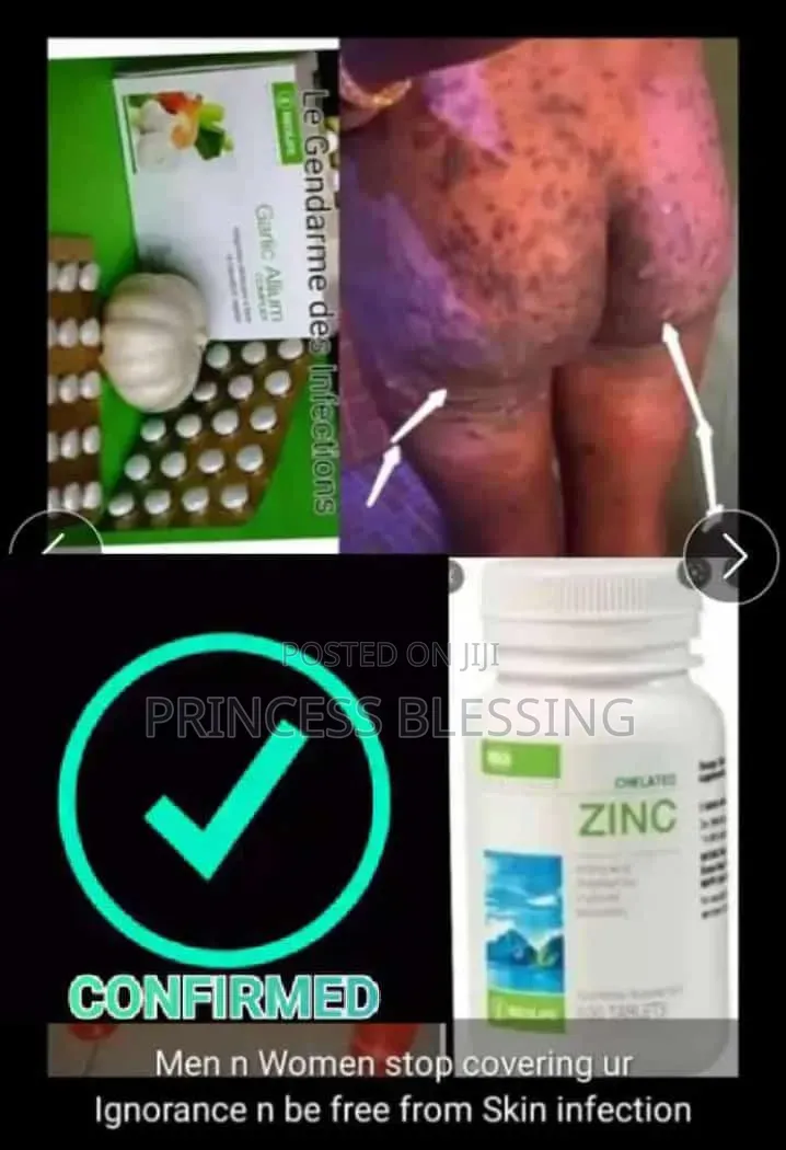 Food Supplements