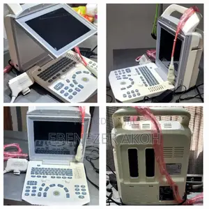 Digital Ultrasound Machine