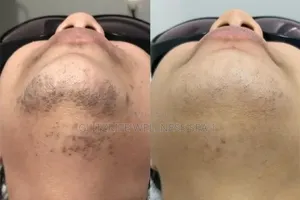 Best Mobile Waxing Services - Lagos
