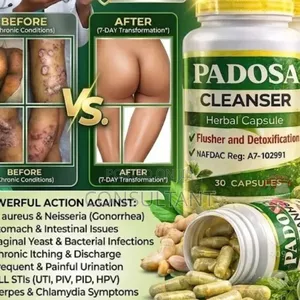Padosa Herbal Capsule (For Infection)