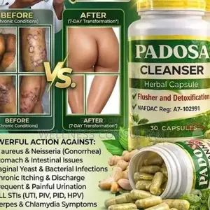Padosa Herbal Capsule (For Infection)