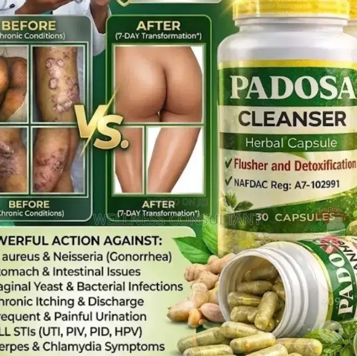 Padosa Herbal Capsule (For Infection)