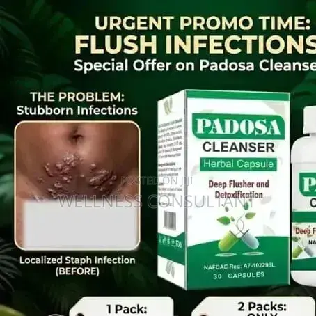 Padosa Herbal Capsule (For Infection)