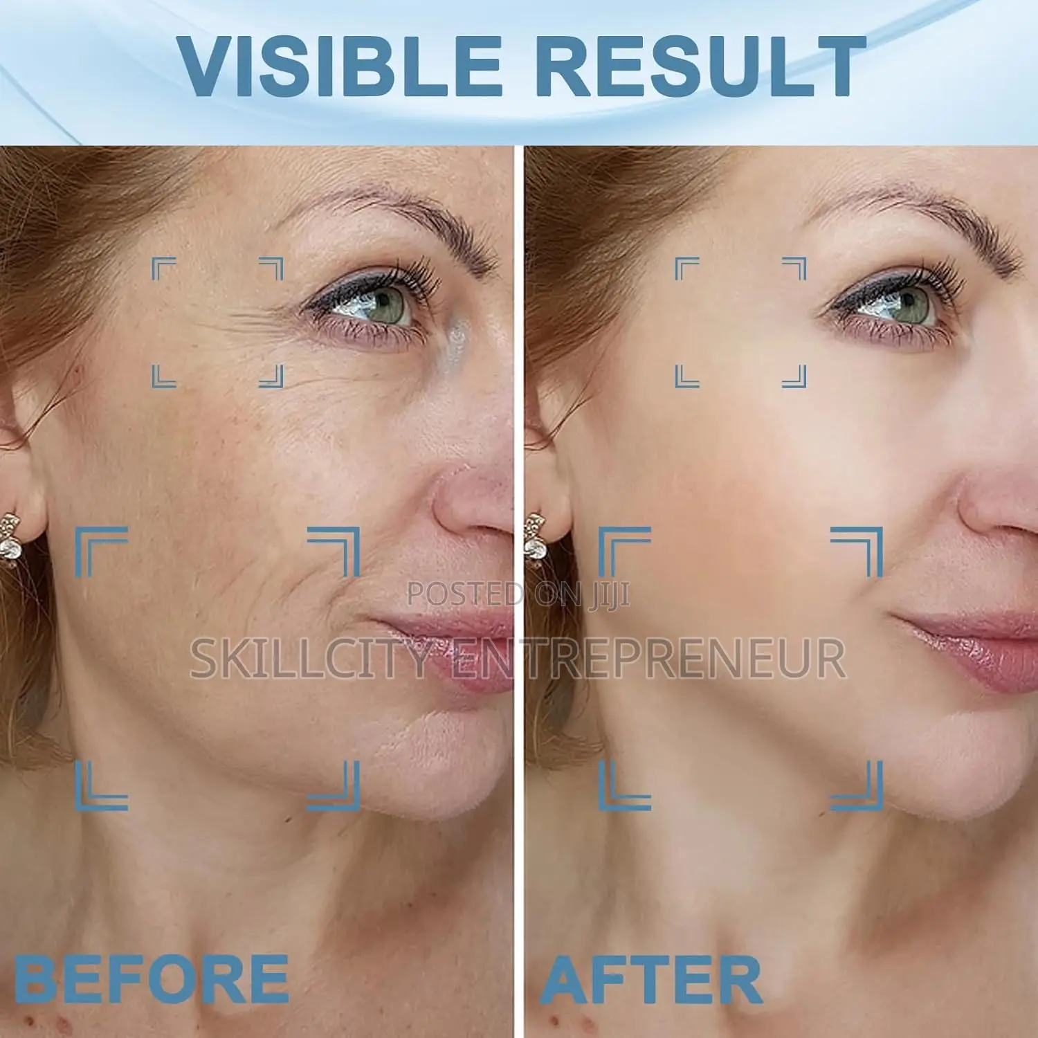 Rechargeable Face Massager