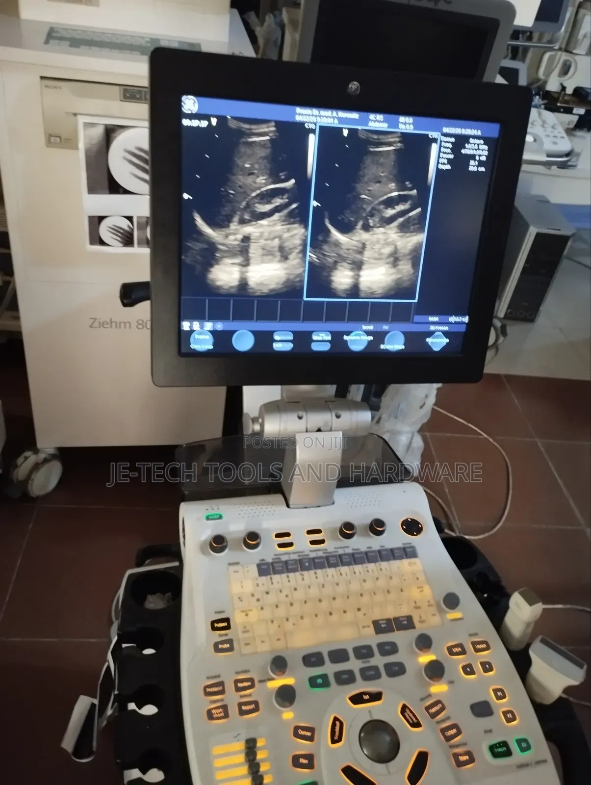 Ge Vivid S6 Ultrasound Machine (Echo)