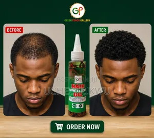 Bald Spot Regrow Oil