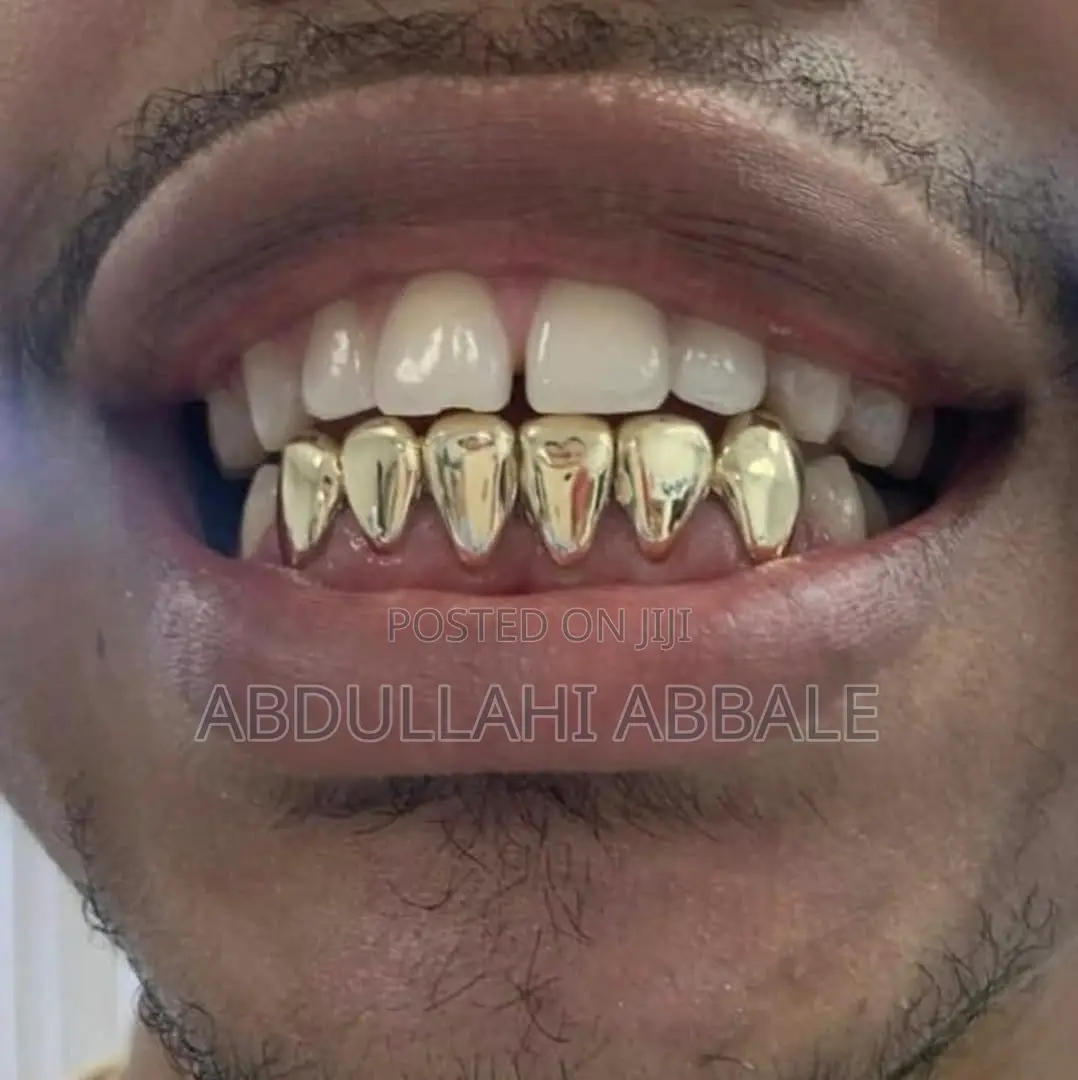 18karat Italian Gold Teeth