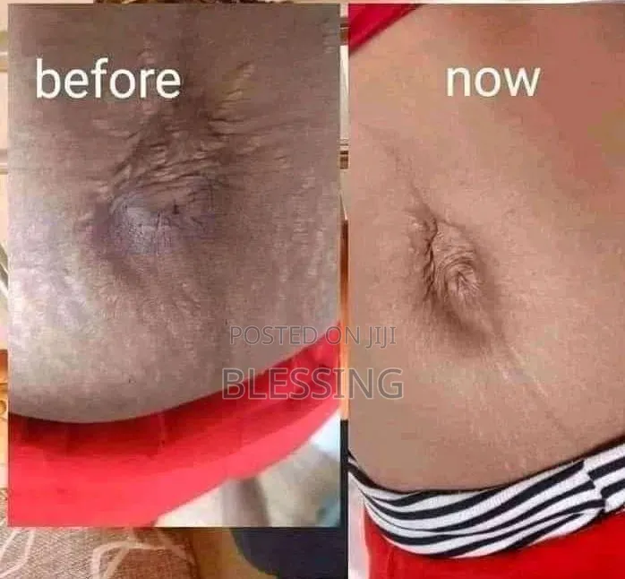 Python Fat Oil Repairer