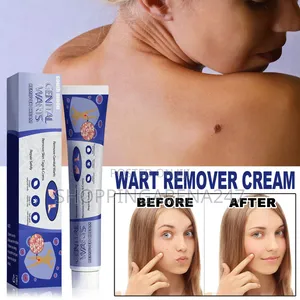 Skin Tag Common Warts Remover Ointment-20g