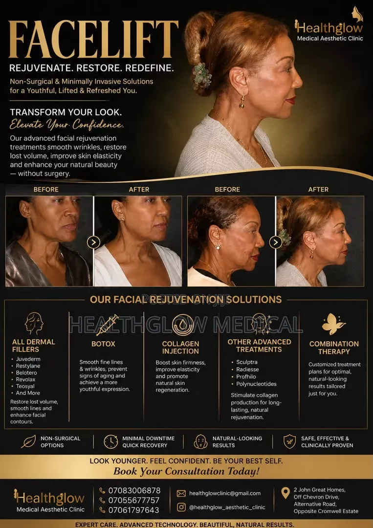 Facelift (Botox and Fillers)