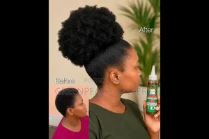 Massive Hair Growth Oil