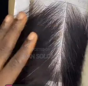 Hair Ventilator