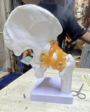 Life-Size Human Hip Joint Anatomy Model - Medical / Teaching Aid