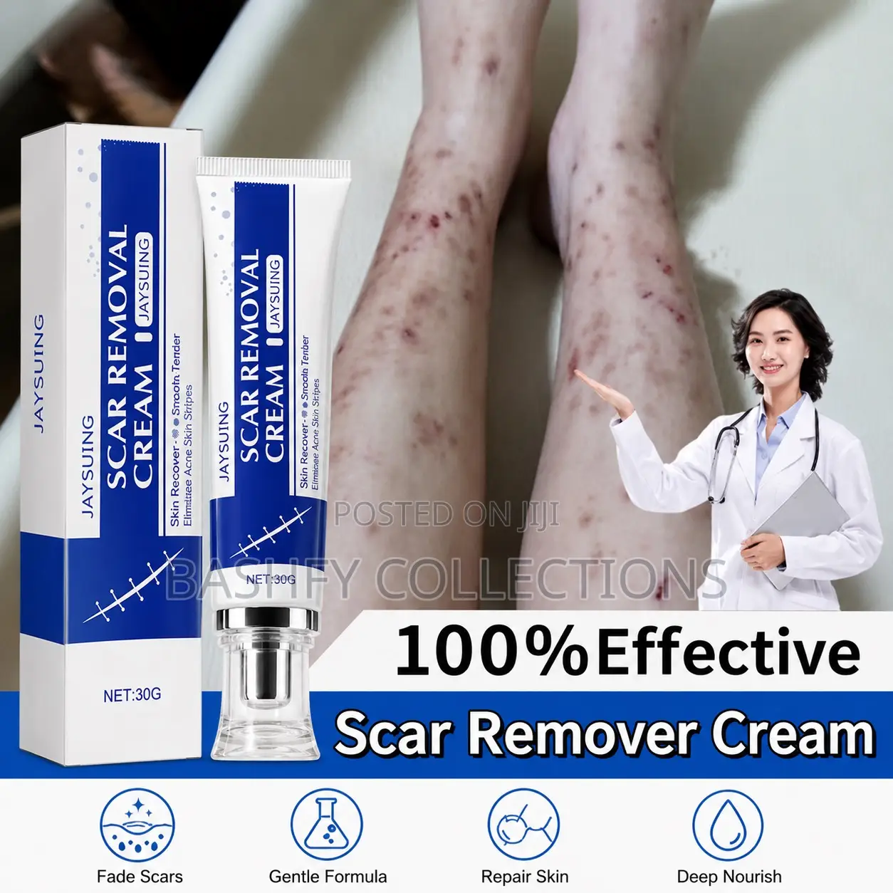 Scar Removal Cream