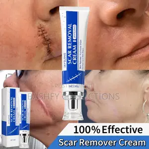 Scar Removal Cream