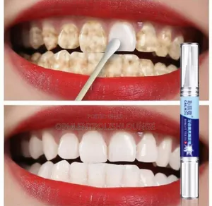 Teeth Whitening Pen