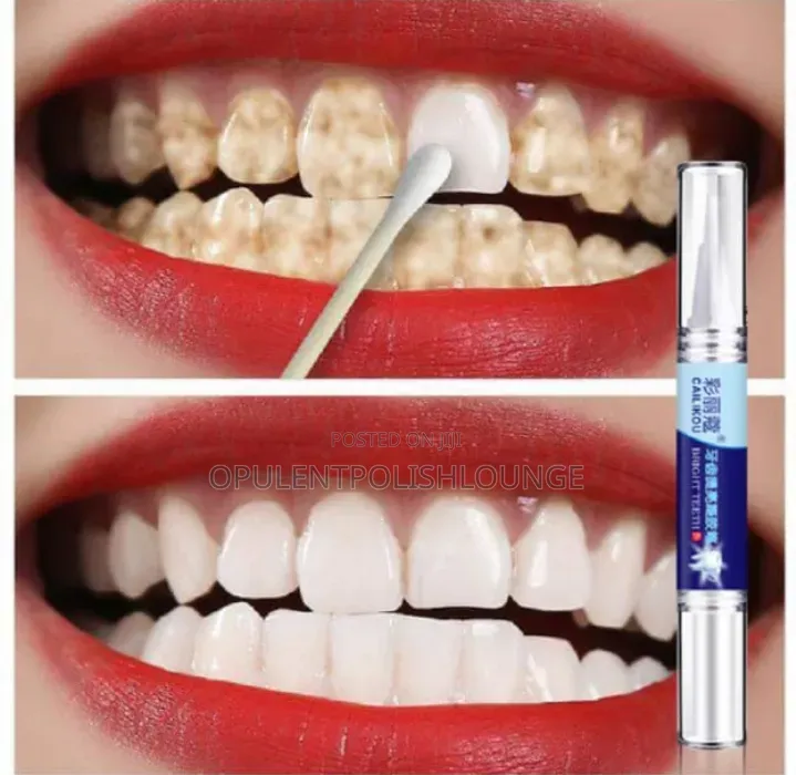 Teeth Whitening Pen