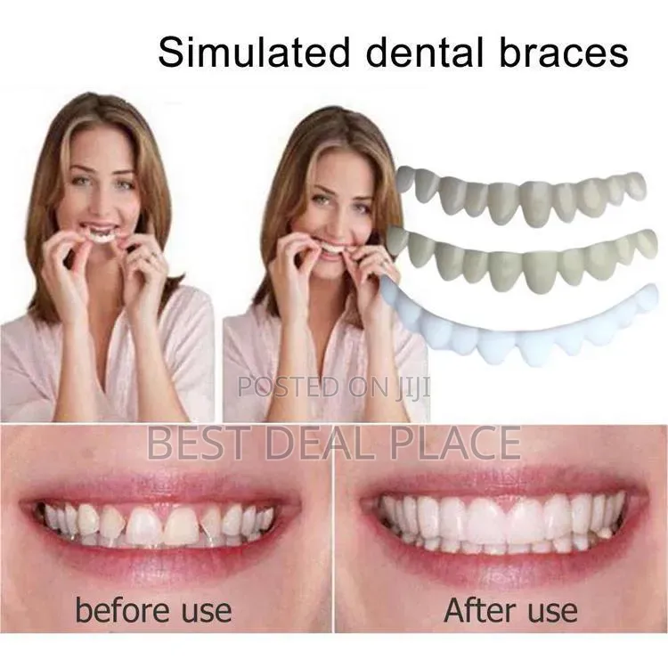 Moldable False Teeth Veneers, Adjustable Temporary Smile Denture