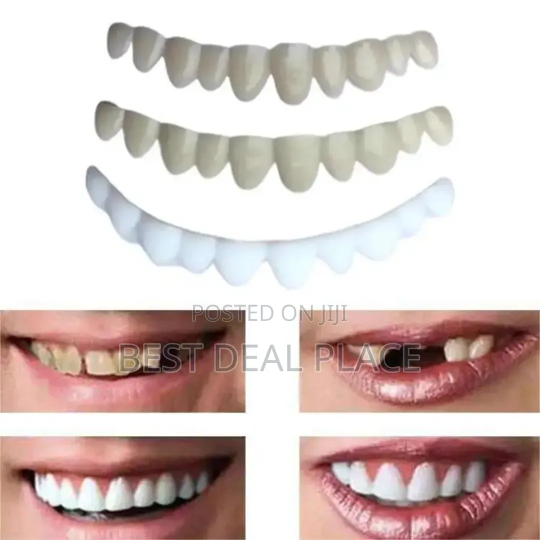 Moldable False Teeth Veneers, Adjustable Temporary Smile Denture