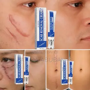 Scar Removal Cream
