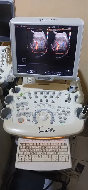 Samsung Medson Sonoace X8