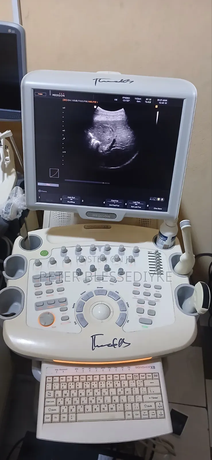 Samsung Medson Sonoace X8