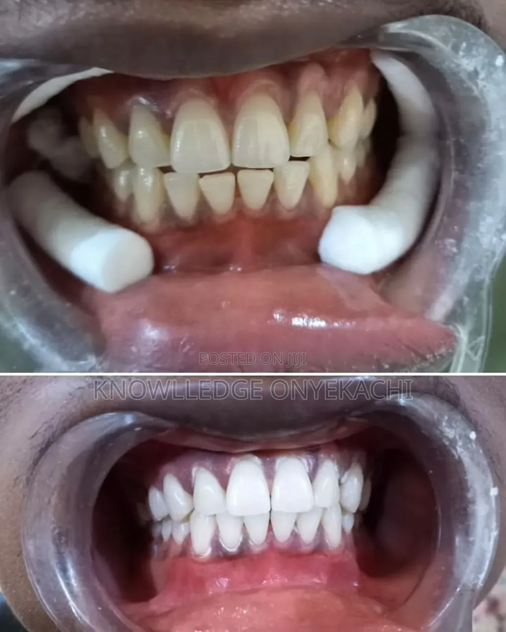 Dental Services