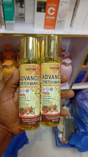 SD Smooth Diamond Advanced Stretch Marks Oil (Stretch Mark Eliminator