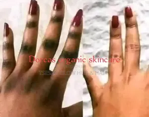 Dark Knuckles,elbows and Inner Thigh Removal
