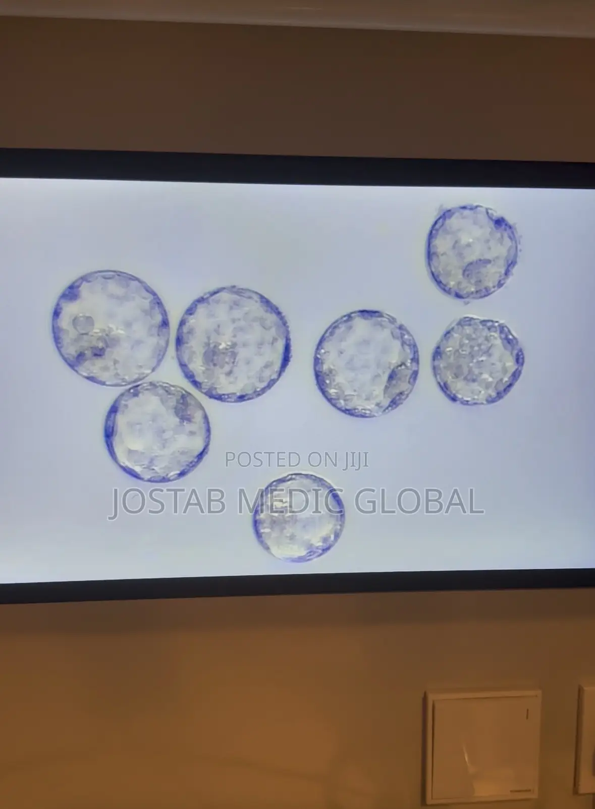 Laminar FlowHood( IVF Workstation