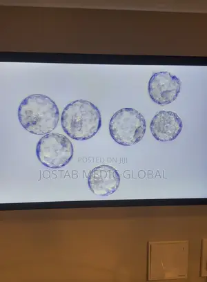Laminar FlowHood( IVF Workstation