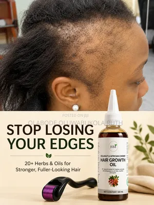 Hair Growth Oil + Dermal Roller Combo | 20+ Herbs for Hair Loss, Edges