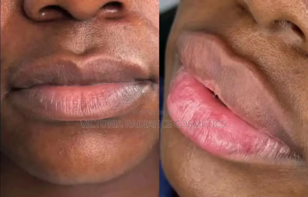 Pink Lips Balm and Lip Scrub