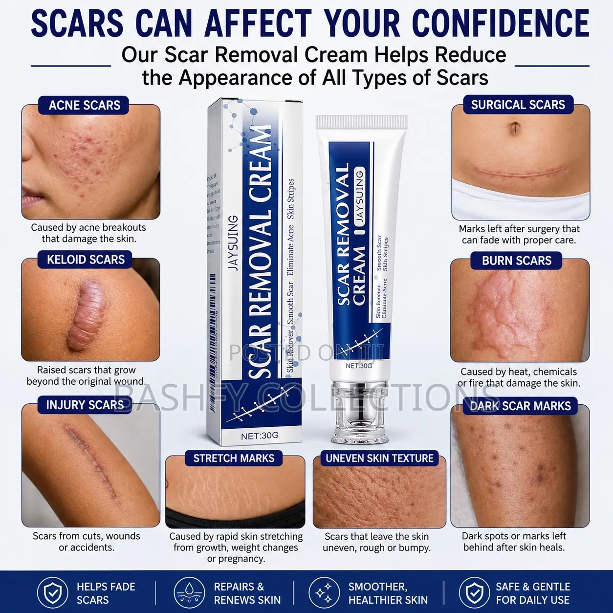 Jaysuing Scar Removal Cream
