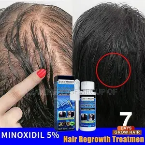 Minoxidil Hair Grower - Increase Hair and Beard Growth