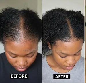 Natural Hair Growth Oil – Fast Hair Growth | 100ml