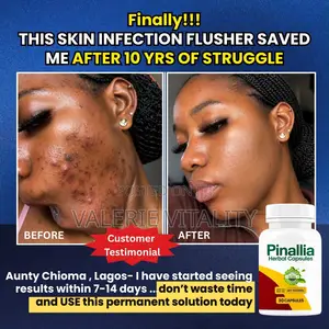 Pinallia Herbal Capsule