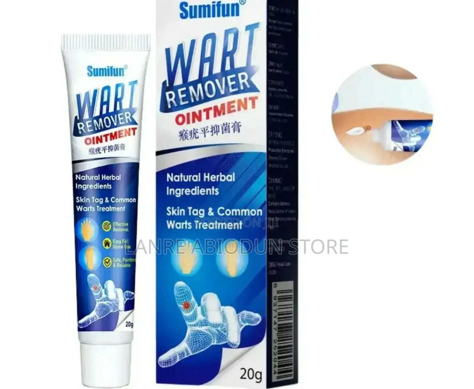 Wart Removal Ointment