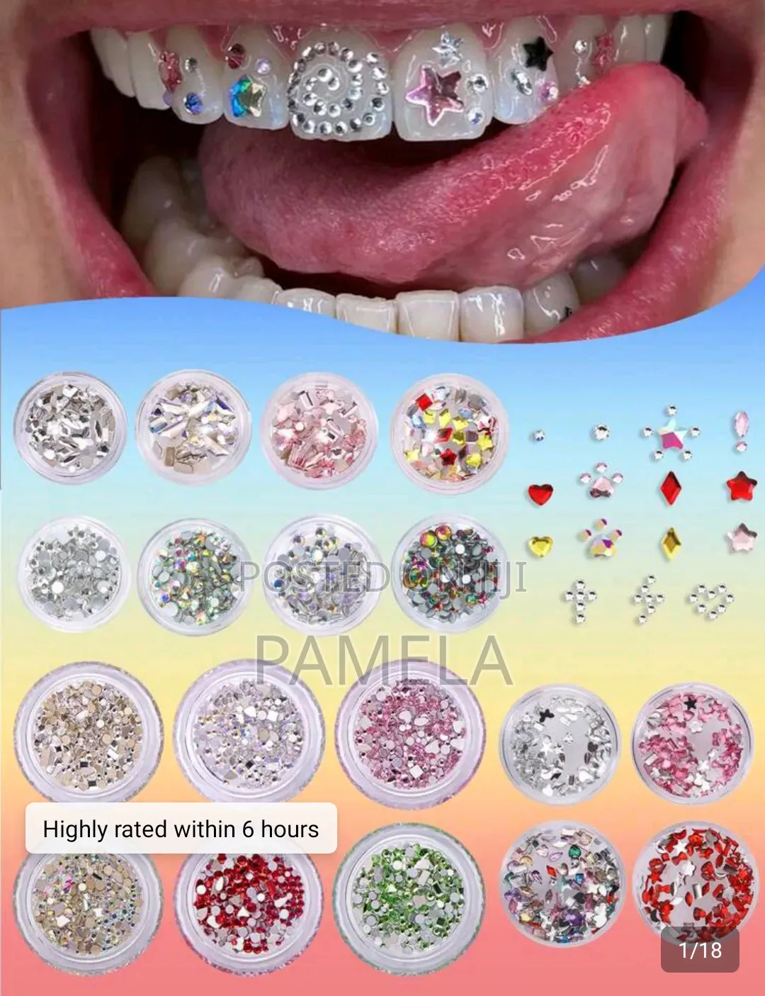 Tooth Gems
