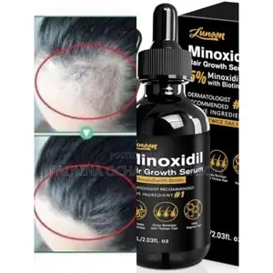 Lunoon Minoxidil Hair Growth Serum 5% With Biotin 60ml