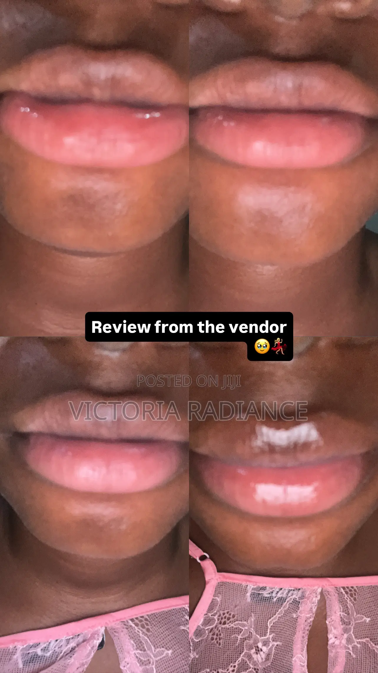 Pink Lips Balm and Lip Scrub