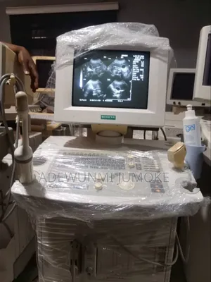 Siemens Prima With TVs Probe and Convex Probe