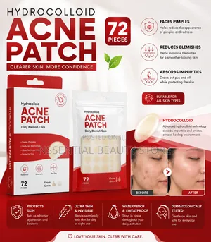 72 PCS of Hydrocolloid Acne Patch, Blemish Removal