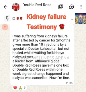 Double Red Rose